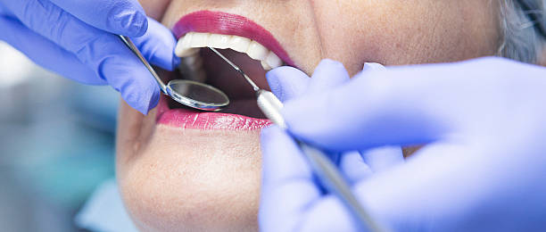 Best Emergency Wisdom Tooth Extraction in Lino Lakes, MN